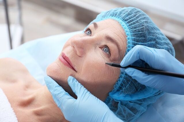 Pregătirea pentru o procedură de lifting facial nechirurgical