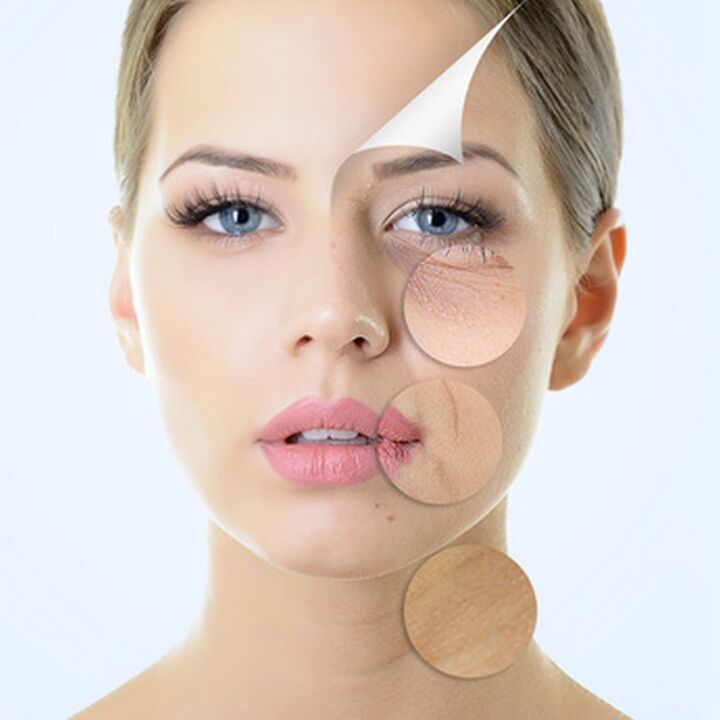 Imperfecțiuni ale pielii feței - indicații pentru procedurile anti-îmbătrânire