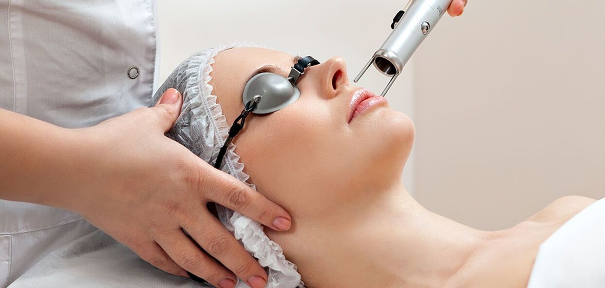 Procedura de peeling cu laser pentru întinerirea pielii feței